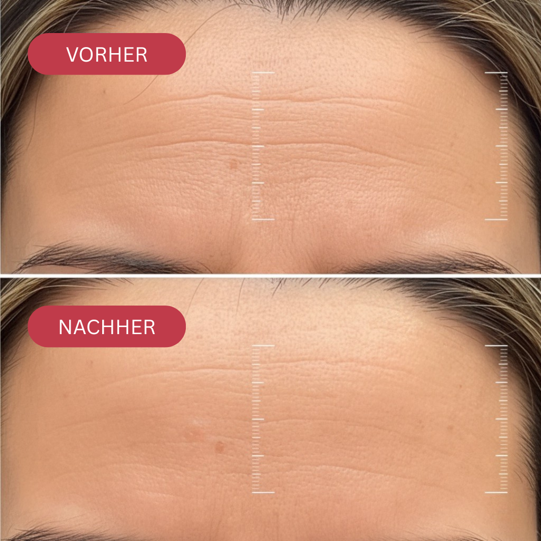 BIO-KOLLAGEN-WRAPPING MASKE + PINSEL